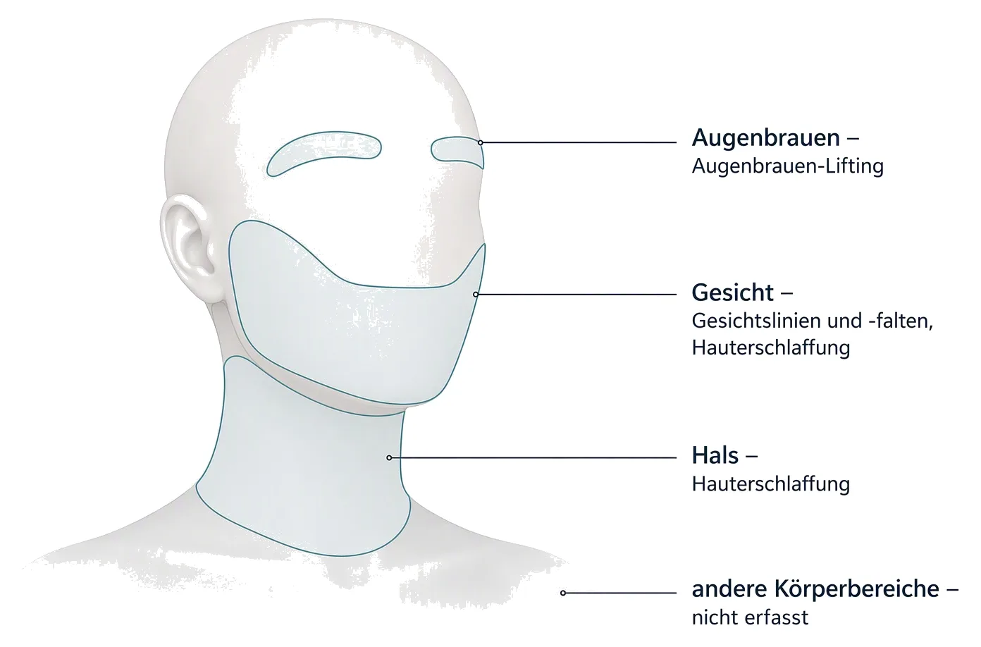 Die drei Zonen der XERF-Zweckbestimmung: Gesicht, Hals und Augenbrauen. Andere Körperbereiche sind nicht erfasst.